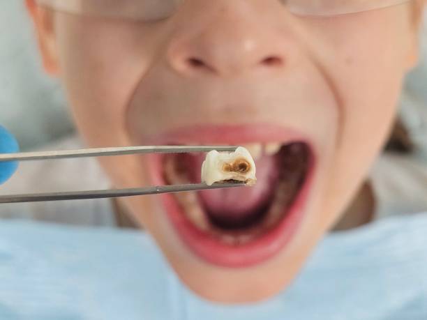 Best Emergency Treatment for Toothache in Veazie, ME